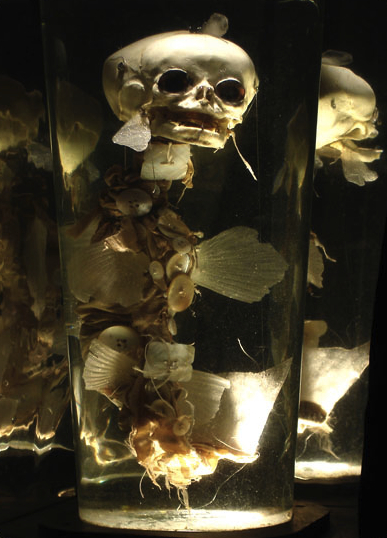 Foetus_in_jar